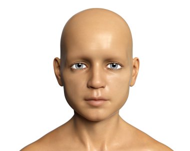 Kılları ve kaşları olmayan bir çocuğun 3 boyutlu çizimi.