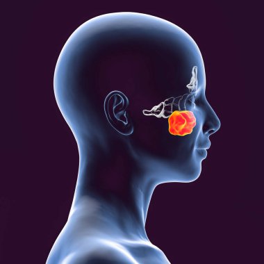 Parazal sinüslerin anatomisi. 3 boyutlu resimde üst çene sinüsleri vurgulanmış bir kadın görülüyor. Ayrıca Highmore Antrumu olarak da bilinir.