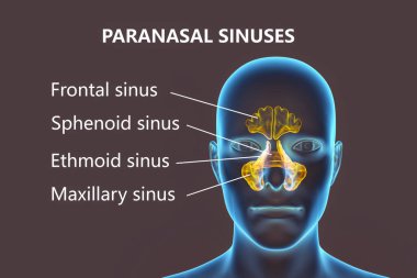 Parazal sinüslerin anatomisi. 3 boyutlu illüstrasyon, parantez sinüsleri, alın, üst çene, etmoid ve sfenoidli bir erkek olduğunu gösteriyor. Etiketlenmiş resim