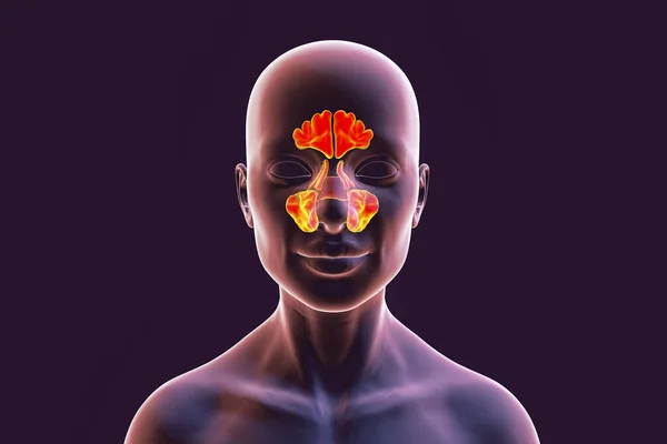 Anatomy Paranasal Sinuses Illustration Showing Female Highlighted Paranasal Sinuses Frontal — Stock Photo, Image