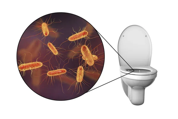 Microbios Inodoro Ilustración Conceptual Transmisión Infecciones Diarreicas Vista Cerca Las — Foto de Stock