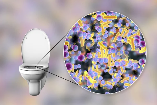 Μικροβίων Τουαλέτας Εννοιολογική Απεικόνιση Μετάδοση Διαρροϊκών Λοιμώξεων Βακτήρια Που Μεταδίδονται — Φωτογραφία Αρχείου