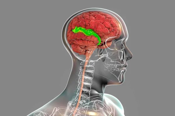 Human brain in body with highlighted superior temporal gyrus, 3D illustration. It is located in the temporal lobe, contains the auditory cortex, and is responsible for the processing of speech