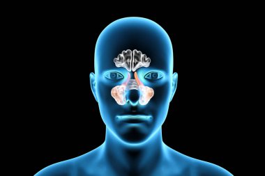 Parazal sinüslerin anatomisi. 3 boyutlu illüstrasyon, etmoid sinüsleri vurgulanmış bir erkek olduğunu gösteriyor, ayrıca etmoid hava hücreleri olarak da bilinir.