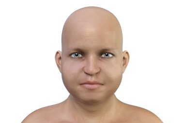 Kılları olmayan şişman bir adamın portresi, 3 boyutlu çizim.