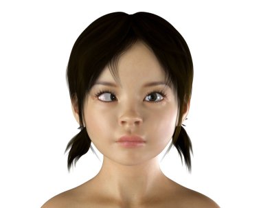 Çocuklarda strabismus, gözün içe doğru döndüğü bir tür göz sapması olan esotropia (dürbün şaşı) gösteren 3D illüstrasyon