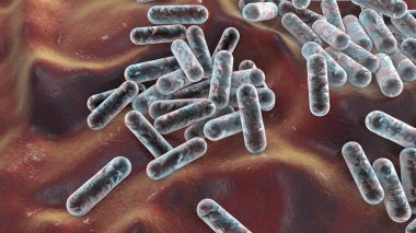 Cutibacterium aknes, eski adıyla Propionibacterium aknes, 3D illüstrasyon. Saç foliküllerinde bulunan bakteriler akne, kronik kanama ve endoftalit gelişimiyle ilişkilidir.