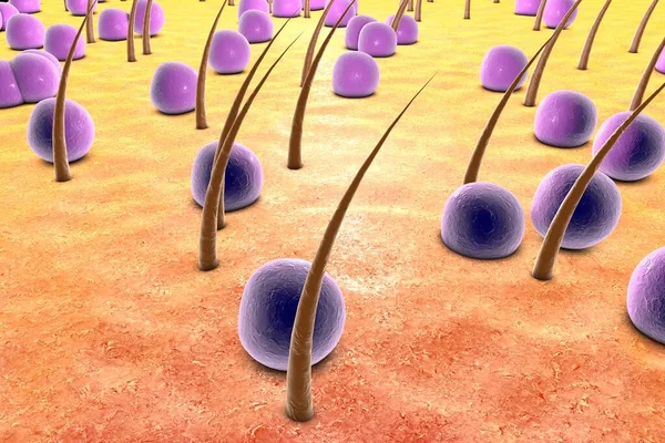 Ilustrasi Dari Bakteri Sferis Pada Kulit Dengan Rambut Tampilan Mikroflora — Stok Foto