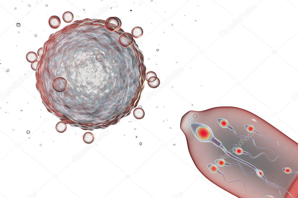 Contraception concept 3D illustration. Eggs cell and condom with spermatozoans