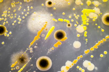 Petri kabında yetişen farklı bakteri ve mantar kolonileri. Mikrobiyoloji arka planı