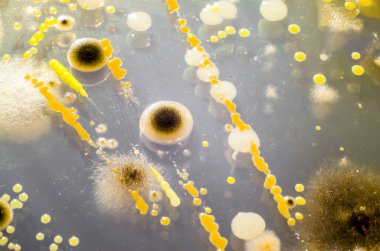 Petri kabında yetişen farklı bakteri ve mantar kolonileri. Mikrobiyoloji arka planı