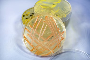 Petri kabında yetişen farklı renklerdeki bakteri ve mantar kültürü ile besin maddeleri, yakın çekim görüntüsü. Mikrobiyoloji arka planı