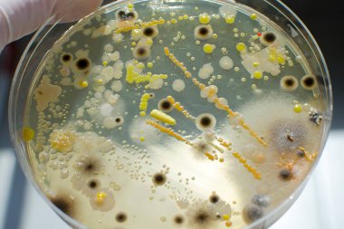 Colonies of different bacteria and mold fungi grown on Petri dish with nutrient agar, close-up view. Microbiology background clipart