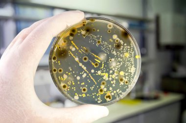 Petri kabında yetişen farklı bakteri ve küf mantarları kolonileri. Besleyici agar, yakın görüş. Araştırma laboratuarında besin ortamına sahip beyaz eldiven tutucu plakasını teslim et.