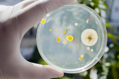 Araştırmacılar, doğal arka planda farklı bakteri ve küf kolonileri ile eldiven içinde Petri kabını tutuyorlar. Biyoteknoloji kavramı