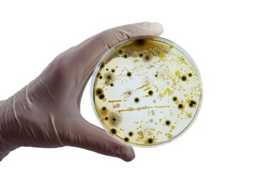 Colonies of different bacteria and mold fungi grown on Petri dish with nutrient agar, close-up view. Hand in white glove holding plate with nutrient medium isolated on white background clipart