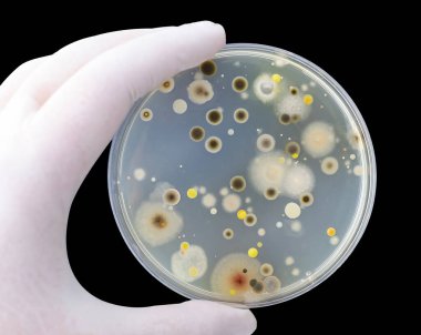 Colonies of different bacteria and mold fungi grown on Petri dish with nutrient agar, close-up view. Hand in white glove holding plate with nutrient medium isolated on black background clipart