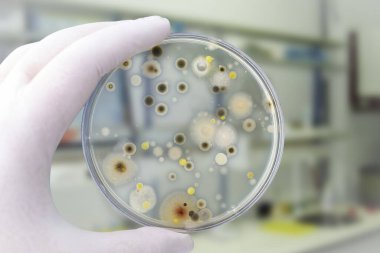 Colonies of different bacteria and mold fungi grown on Petri dish with nutrient agar, close-up view. Hand in white glove holding plate with nutrient medium in research laboratory clipart