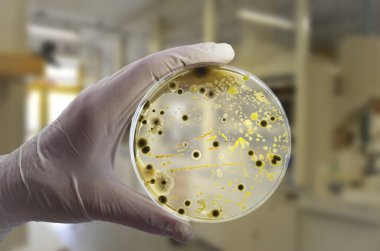 Petri kabında yetişen farklı bakteri ve küf mantarları kolonileri. Besleyici agar, yakın görüş. Araştırma laboratuarında besin ortamına sahip beyaz eldiven tutucu plakasını teslim et.