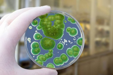 Petri kabını Penicillium mantar kolonileriyle tutan araştırmacı. Penisilyum, peynir üretiminde kullanılan ve antibiyotik penisilin üreten bir mantar türüdür.