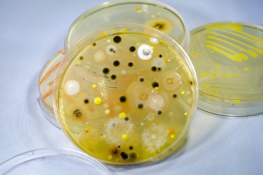 Petri kabında yetişen farklı bakteri ve küf mantarları kolonileri. Besleyici agar, yakın görüş. Mikrobiyoloji arka planı