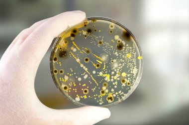 Petri kabında yetişen farklı bakteri ve küf mantarları kolonileri. Besleyici agar, yakın görüş. Araştırma laboratuarında besin ortamına sahip beyaz eldiven tutucu plakasını teslim et.
