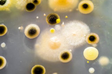 Petri kabında yetişen farklı bakteri ve küf mantarları kolonileri. Besleyici agar, yakın görüş. Mikrobiyoloji arka planı