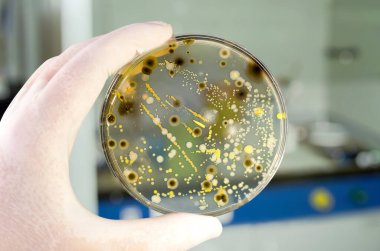 Petri kabında yetişen farklı bakteri ve küf mantarları kolonileri. Besleyici agar, yakın görüş. Araştırma laboratuarında besin ortamına sahip beyaz eldiven tutucu plakasını teslim et.