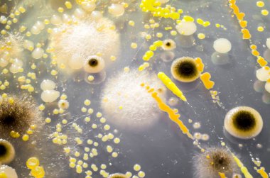 Petri kabında yetişen farklı bakteri ve mantar kolonileri. Mikrobiyoloji arka planı