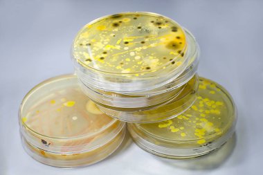 Petri kabında yetişen farklı bakteri ve küf mantarları kolonileri. Besleyici agar, yakın görüş. Mikrobiyoloji arka planı