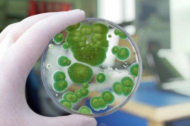 Petri kabını Penicillium mantar kolonileriyle tutan araştırmacı. Penisilyum, peynir üretiminde kullanılan ve antibiyotik penisilin üreten bir mantar türüdür.