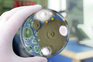 Farklı küf mantarları kolonileri, kapalı havadan Sabourad dekstroz agar ile Petri kabında büyüdüler, yakın görüş. Araştırma laboratuarında mikroplarla dolu beyaz eldiven taşıyın.