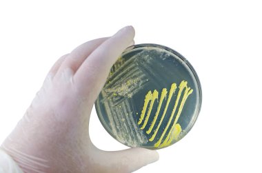 Petri kabında yetişen farklı bakteri ve küf mantarları kolonileri. Besleyici agar, yakın görüş. Beyaz arka planda izole edilmiş mikroplarla dolu beyaz eldiven tutacağı.