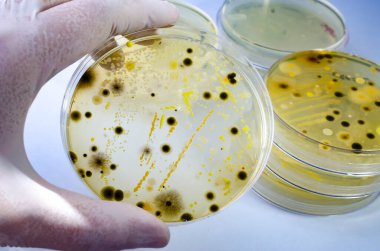 Petri kabında yetişen farklı bakteri ve küf mantarları kolonileri. Besleyici agar, yakın görüş. Beyaz eldiven içinde mikroplarla dolu bir tabak.