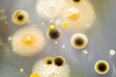 Petri kabında yetişen farklı bakteri ve küf mantarları kolonileri. Besleyici agar, yakın görüş. Mikrobiyoloji arka planı