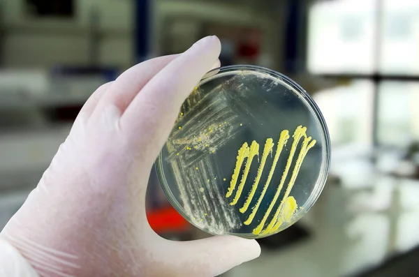 종류의 박테리아와 곰팡이 균들이 페트리 접시에서 배양되어 영양소가 시야를 가지고 — 스톡 사진