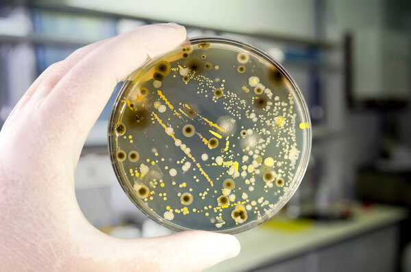 Colonies of different bacteria and mold fungi grown on Petri dish with nutrient agar, close-up view. Hand in white glove holding plate with nutrient medium in research laboratory