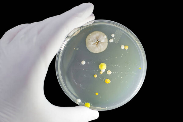Colonies of different bacteria and mold fungi grown on Petri dish with nutrient agar, close-up view, isolated on black background