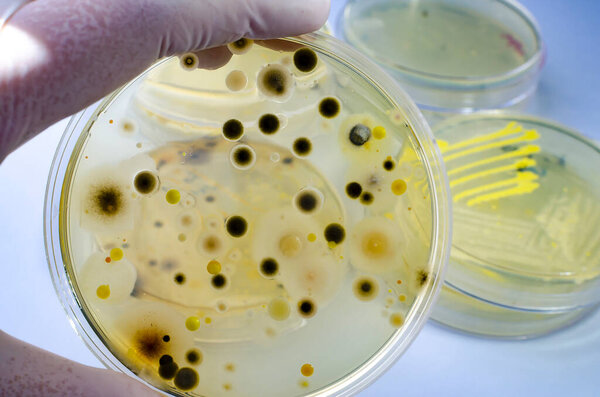Colonies of different bacteria and mold fungi grown on Petri dish with nutrient agar, close-up view. Hand in white glove holding plate with microbes