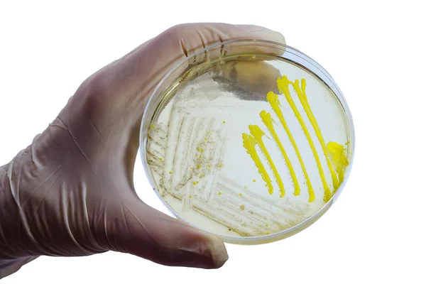 Colonias Diferentes Bacterias Hongos Moho Cultivados Placa Petri Con Agar — Foto de Stock