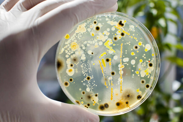 Researcher hand in glove holding Petri dish with colonies of different bacteria and molds on natural background. Biotechnology concept
