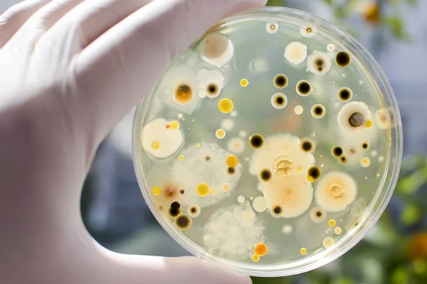 Naukowiec Ręka Rękawicy Gospodarstwa Płytki Petri Kolonii Różnych Bakterii Pleśni — Zdjęcie stockowe
