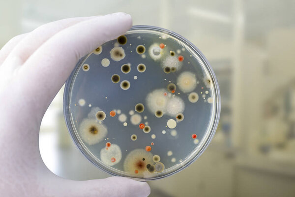 Colonies of different bacteria and mold fungi grown on Petri dish with nutrient agar, close-up view. Hand in white glove holding plate with nutrient medium in research laboratory