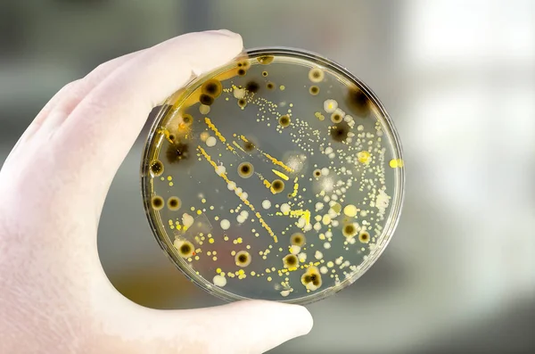 Colonies Different Bacteria Mold Fungi Grown Petri Dish Nutrient Agar Stock Image