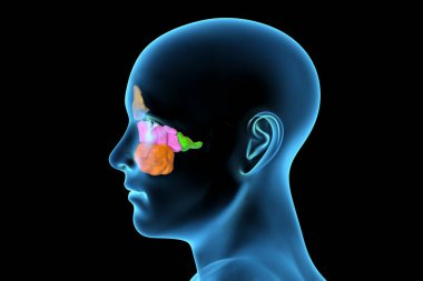 Parazal sinüslerin anatomisi. 3 boyutlu resimleme, insan vücudunda vurgulanmış paranasal sinüsler, alın, üst çene, etmoid ve sfenoid olduğunu gösteriyor. Yan görünüm