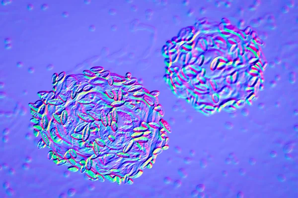 Bakteriyel vajinoz. 3 boyutlu illüstrasyonlar vajinal lekelerde, 3 boyutlu illüstrasyonda bulunan ve Gardnerella vajinalis olarak adlandırılan bakterilerle kaplı epitel hücreleri gösteriyor.