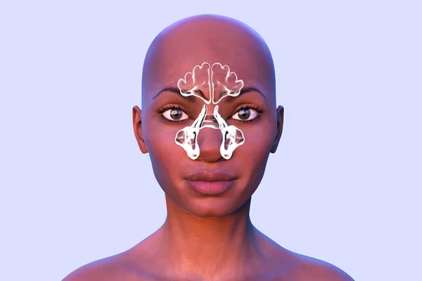 Anatomy of paranasal cavities, 3D illustration showing paranasal sinuses highlighted on a human face