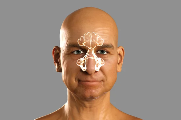 Paranasal Boşlukların Anatomisi Erkek Yüzünde Parasal Sinüslerin Işaretlendiğini Gösteren Boyutlu — Stok fotoğraf