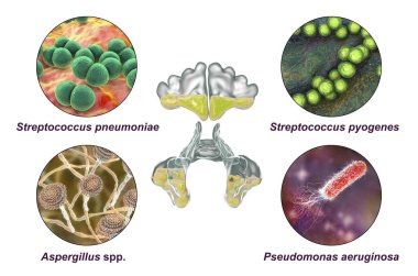 Sinüzit bakterisi Streptococcus pneumoniae, Streptococcus pyogenes, mantar Aspergillus, Pseudomonas aeruginosa, 3 boyutlu illüstrasyon etiketli bakterilerin anatomisi ve mikroorganizmaların