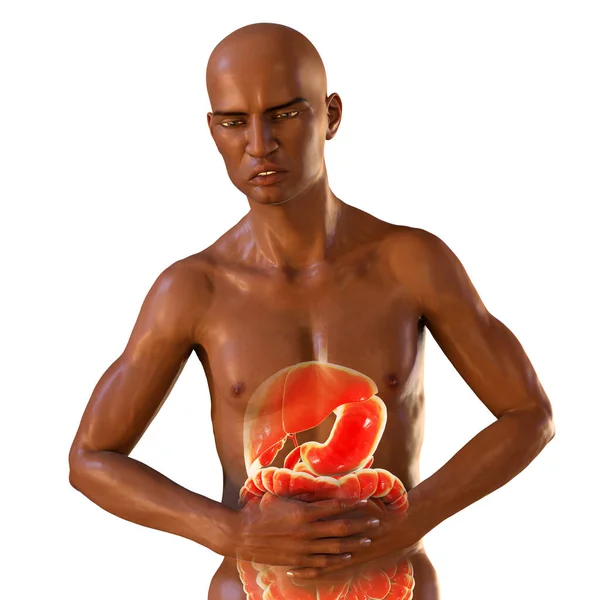 Karın Ağrısı Kavramsal Boyutlu Illüstrasyon Organları Vurgulanmış Midesi Ağrıyan Koyu — Stok fotoğraf